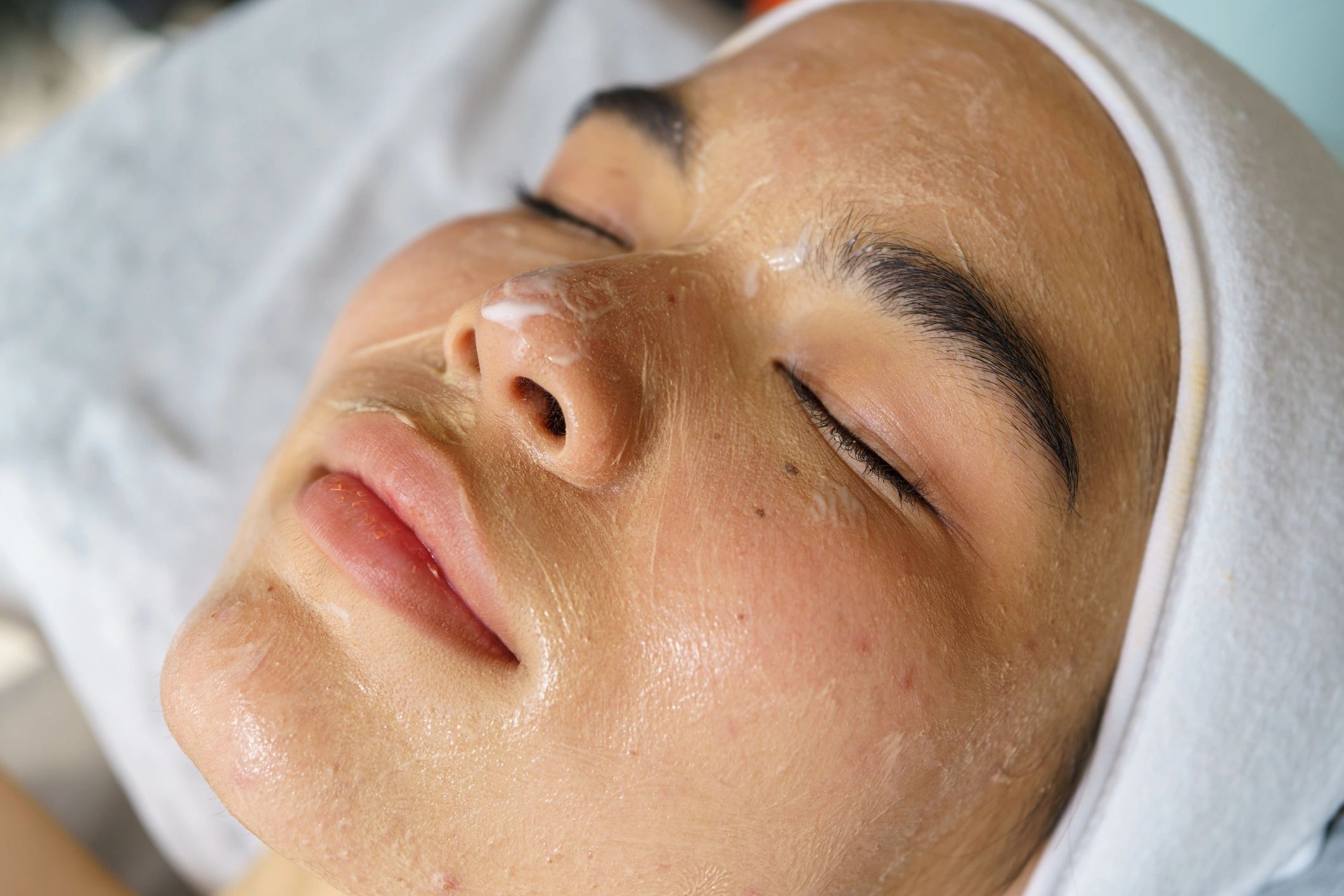 facial treatment aesthetic