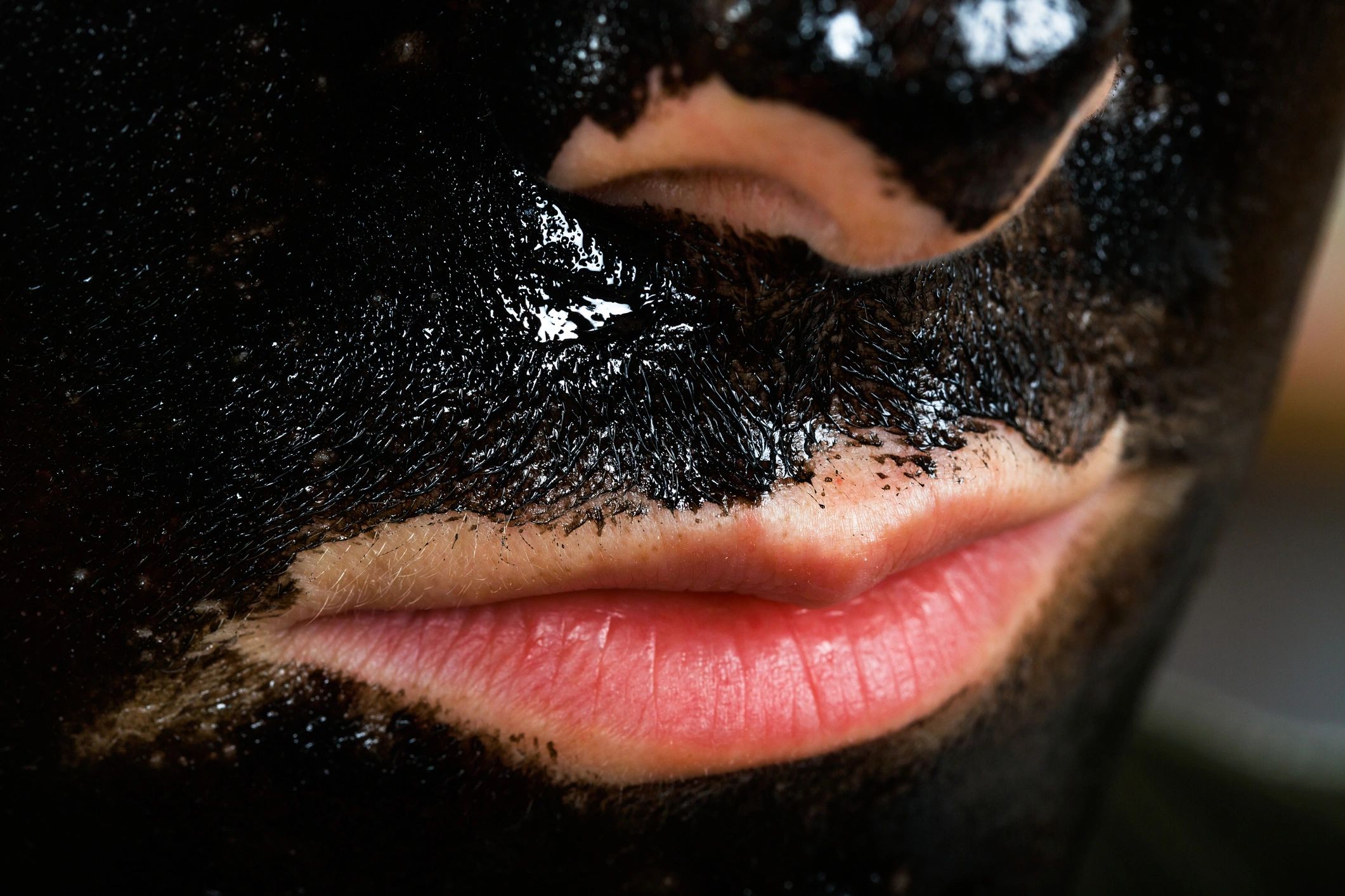 aesthetic nurse facial treatment